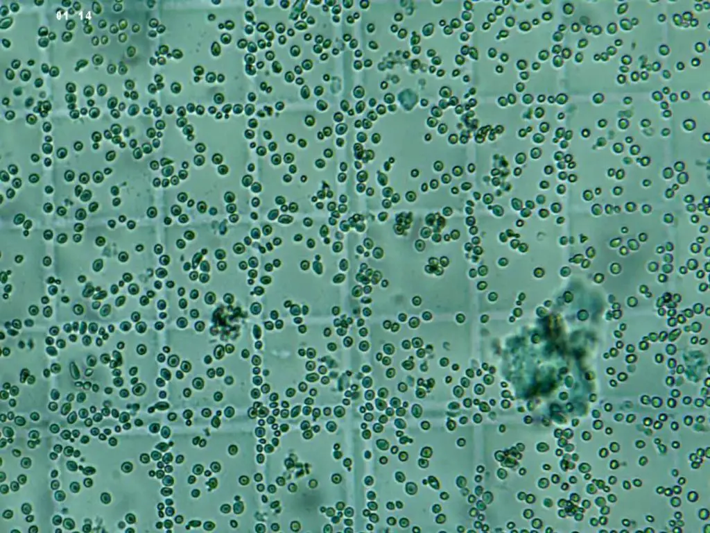 Saccharomyces Boulardii Bacteria