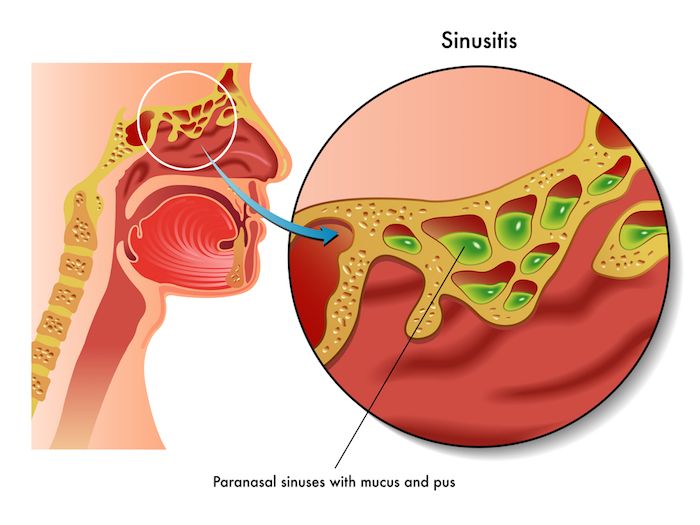 Mucous